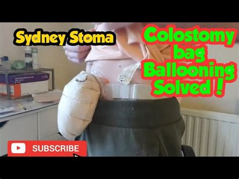 stoma bag ballooning|stoma blockage problems.